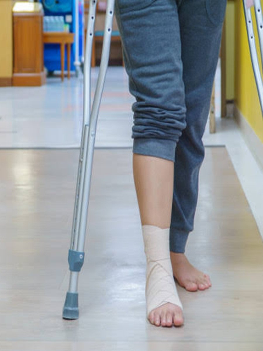 After - Knee Rehabilitation After Injury