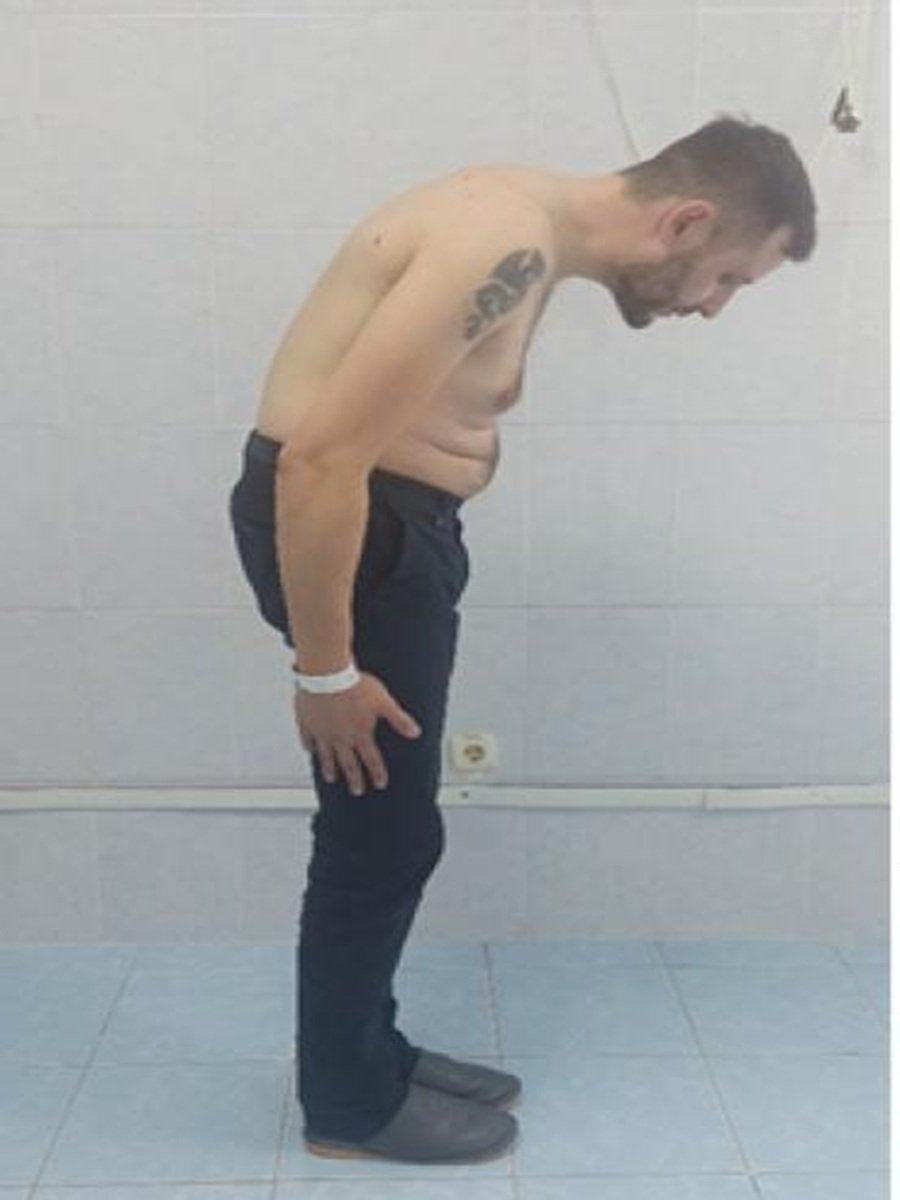 Before - Lower Back Pain Management